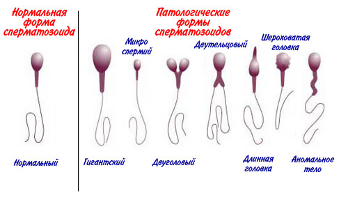 analiz spermy 2