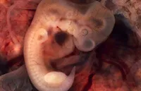anatomiya zhenshchiny 6