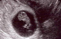 Развитие эмбриона на 9 неделе