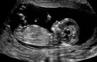 Развитие эмбриона на 12 неделе
