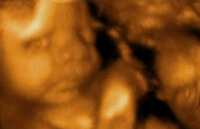 Развитие эмбриона на 29 неделе